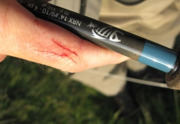 The fingers were starting to get chewed up... The fingers were starting to get chewed up...